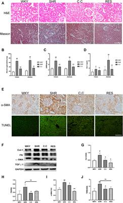 Cordyceps cicadae Ameliorates Renal Hypertensive Injury and Fibrosis Through the Regulation of SIRT1-Mediated Autophagy